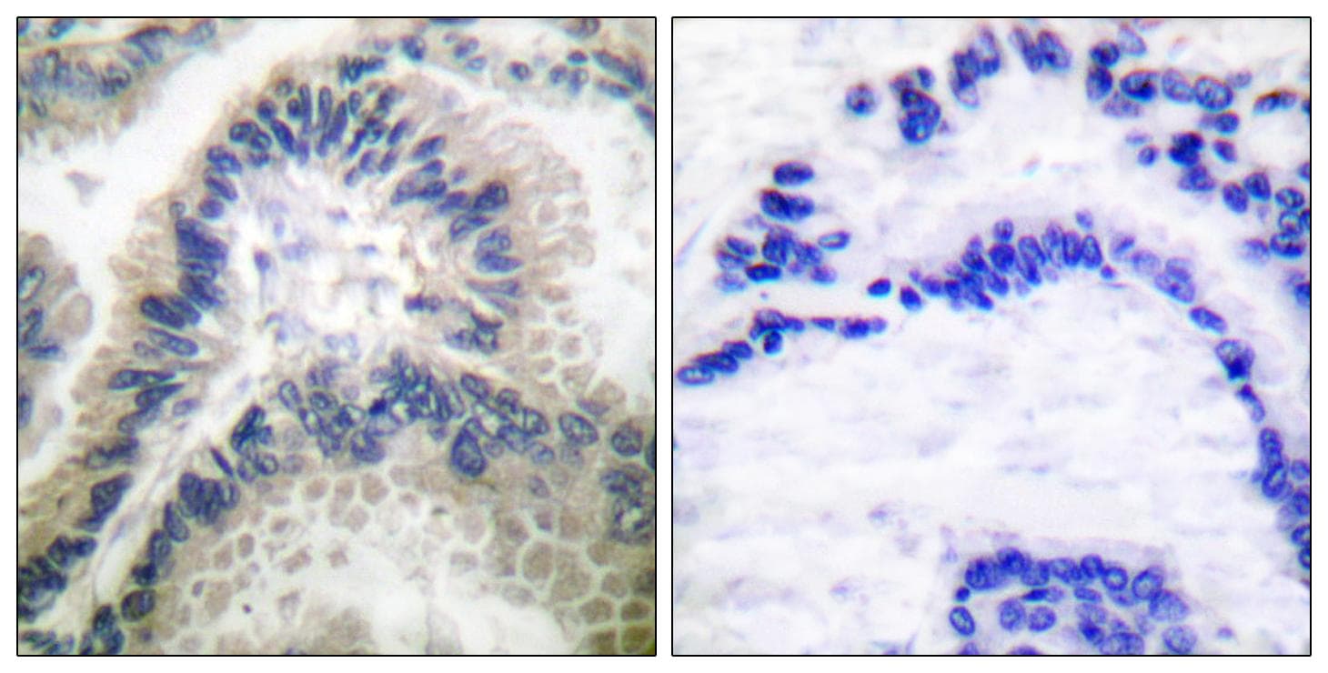 GUCY1B3 Antibody