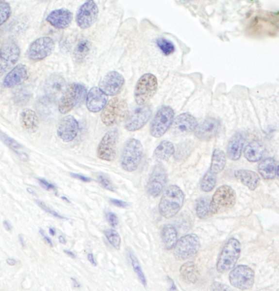 Polyclonal Rabbit anti-Human GTF3C1 Antibody (aa2059-2109, IHC, WB)