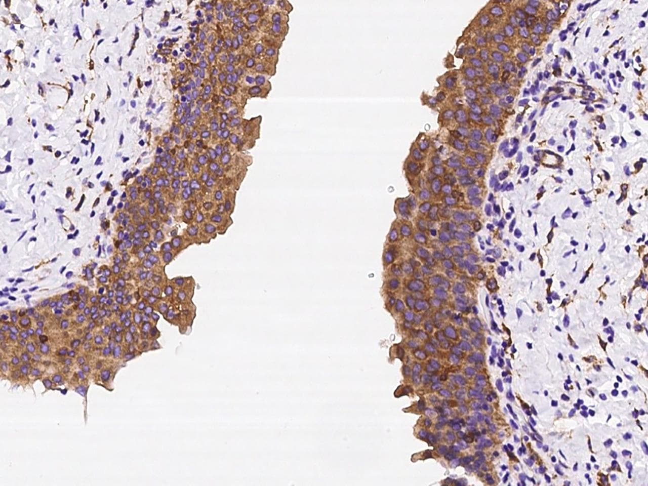 Polyclonal Rabbit anti-Human CORO1B Antibody (IHC)
