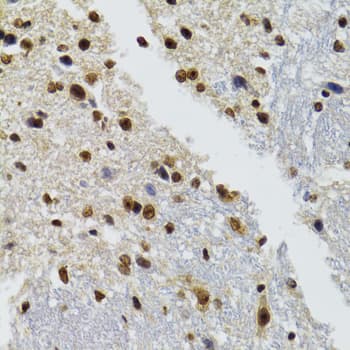 BAZ1B / WSTF Antibody