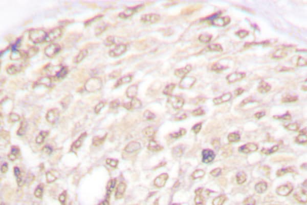 CDKN2C / p18 INK4c Antibody (Asp142)
