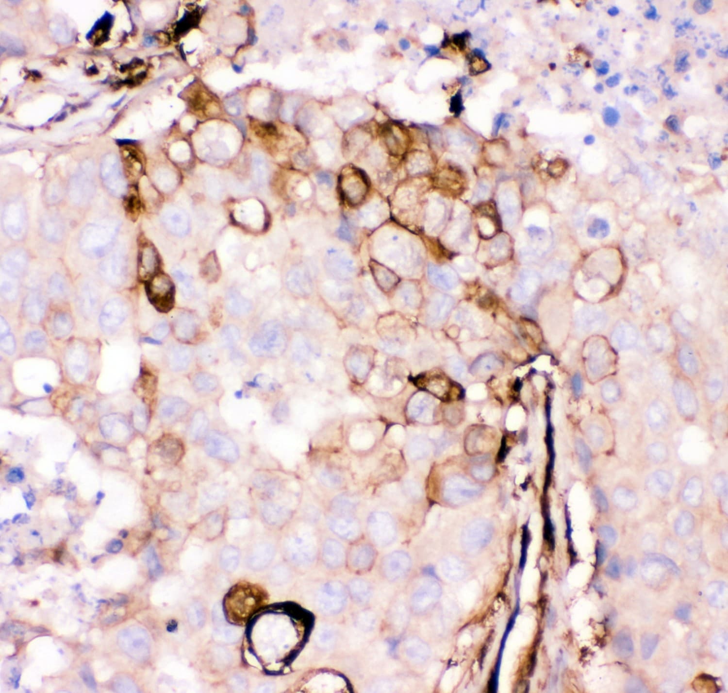 Polyclonal Rabbit anti-Human GSN / Gelsolin Antibody (aa580-782, IHC, WB)