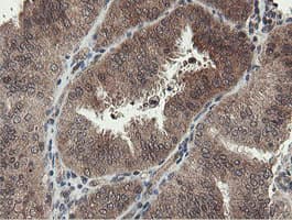 PROSC Antibody (clone OTI3G7)