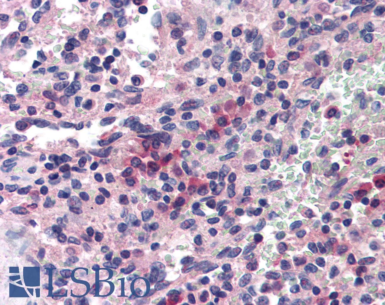 IHC-plus™ SAE1 Antibody