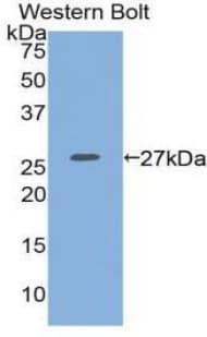 ITGA2 / CD49b Antibody (aa170-361)