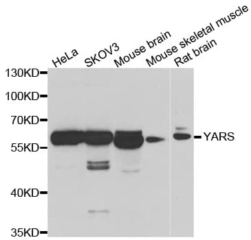 YARS / Tyrosyl-tRNA Synthetase Antibody