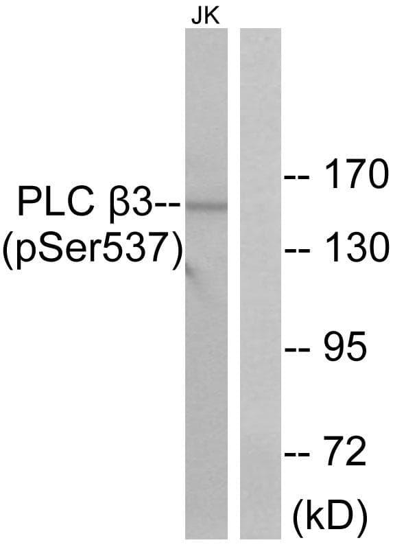 PLCB3 Antibody (phospho-Ser537)