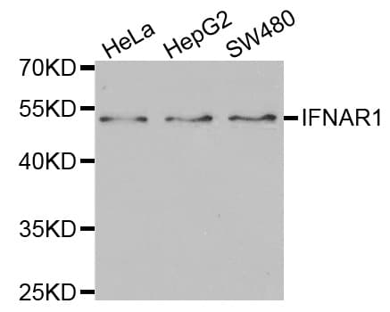 IFNAR1 / IFNAR Antibody