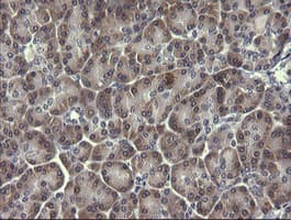 PIK3R5 Antibody (clone OTI2E4, Carrier-free)