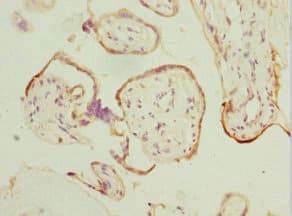 HEXIM1 Antibody
