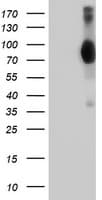 VCAM1 / CD106 Antibody (clone OTI5B12)