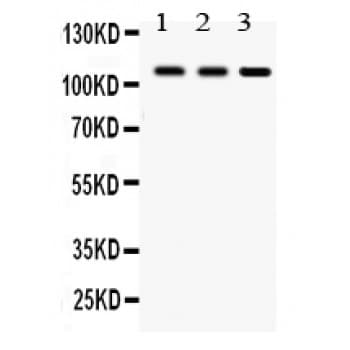 Polyclonal Rabbit anti-Human CYLD Antibody (aa618-956, WB)