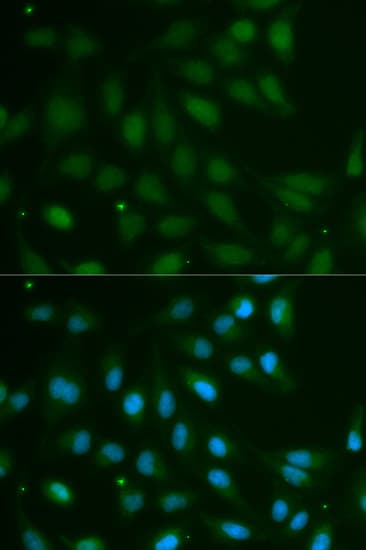 ABO Glycosyltransferase Antibody