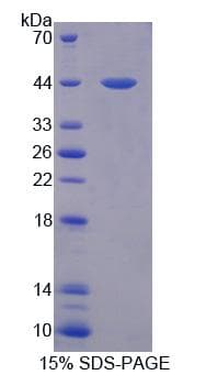 Human KLF15 Protein (Recombinant His-T7)
