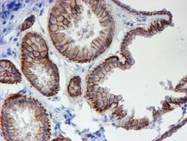 Monoclonal Mouse anti-Human ERBB2 / HER2 Antibody (clone OTI12G4, Carrier-free, aa676-1255, IHC, IF, WB)