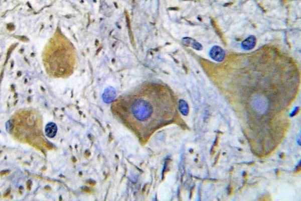 Polyclonal Rabbit anti-Human GRIN1 / NMDAR1 Antibody (phospho-Ser896, IHC)