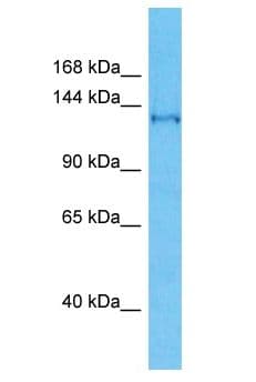 SFI1 Antibody (aa966-1015)