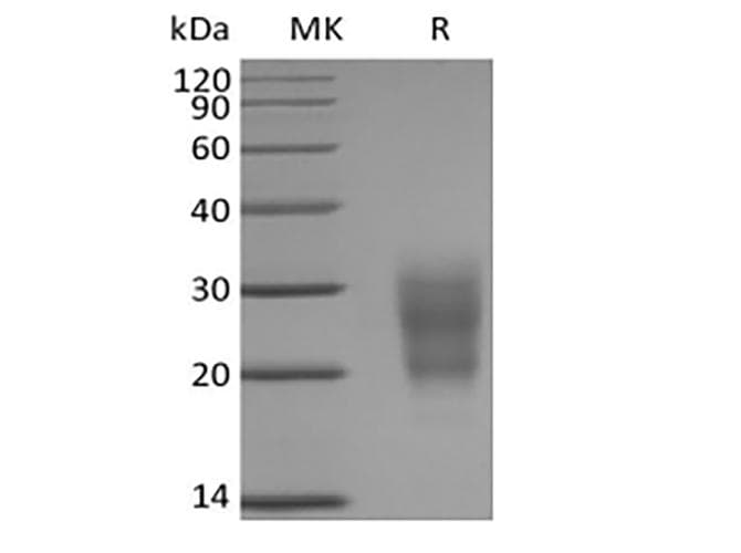 Mouse Gb:x54870_rna1 Nkg2-d Type II Integral Membrane Protein (HUMAN);contains Alu Repetitive Element;contains Element Mer33 Repetitive Element ; (Recombinant 6His, N-terminus)