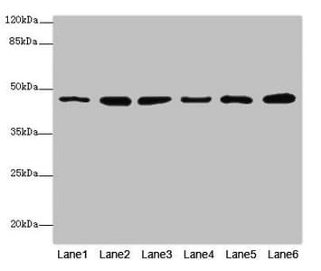 Mannose Phosphate Isomerase Antibody