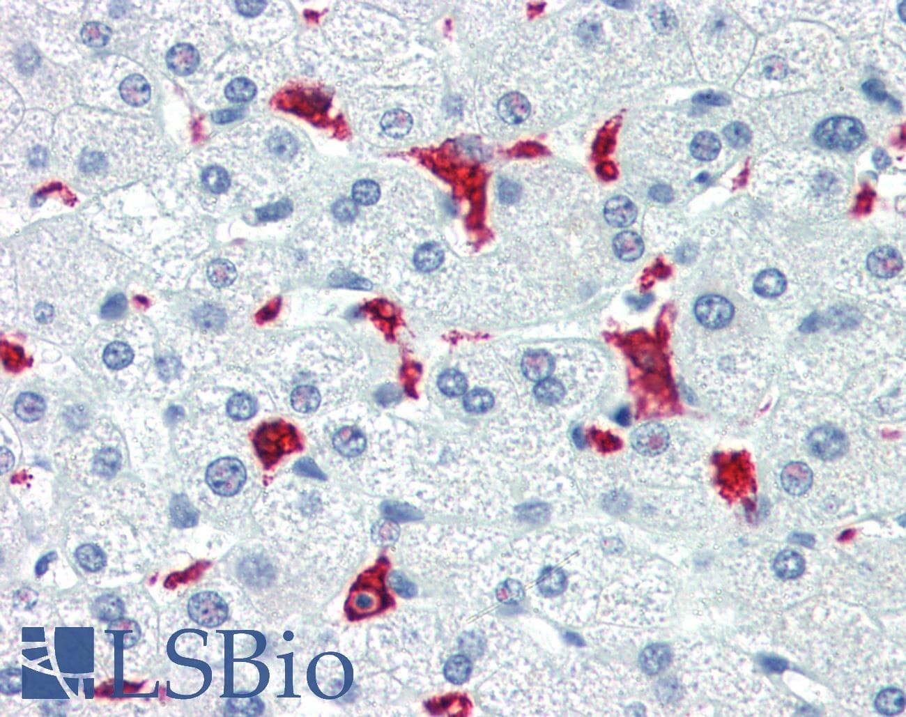 IHC-plus™ HMOX1 / HO-1 Antibody (clone 5F12-B10)