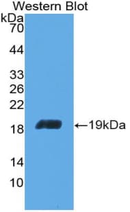 ACO1 / Aconitase Antibody (aa669-834)
