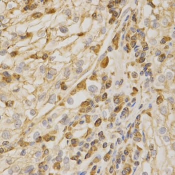 Polyclonal Rabbit anti-Human BAK1 / BAK Antibody (IHC, IF, WB)