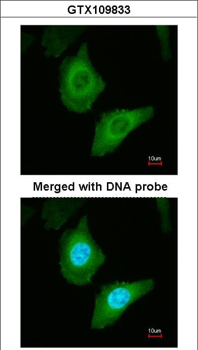 FASN / Fatty Acid Synthase Antibody (aa7-287)
