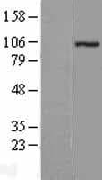 Human ATAC1 / ZZZ3 Protein (Over-Expression Lysate Myc-DDK (Flag))