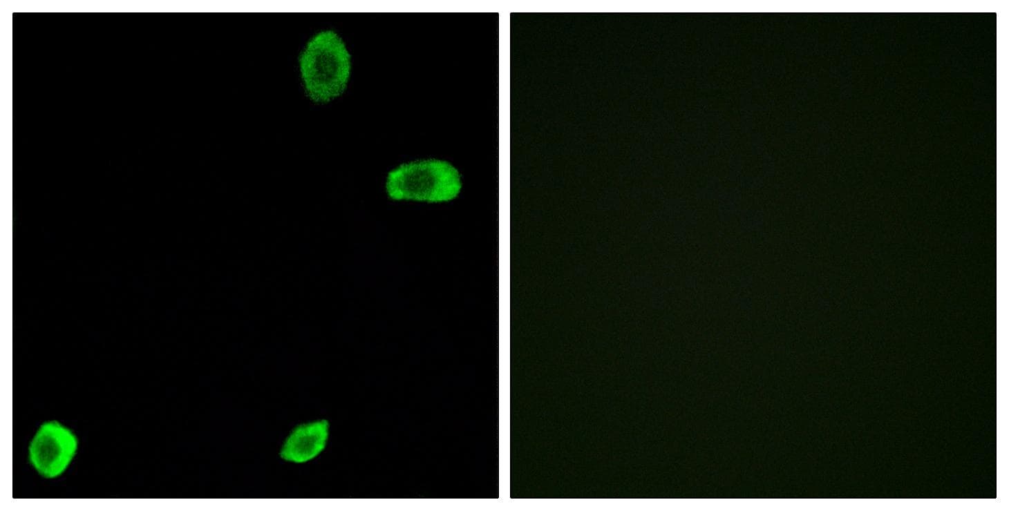Polyclonal Rabbit anti-Human TAS2R39 Antibody (IF, WB)