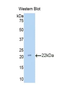 LAMC3 / Laminin Gamma 3 Antibody (aa1250-1418, PE)
