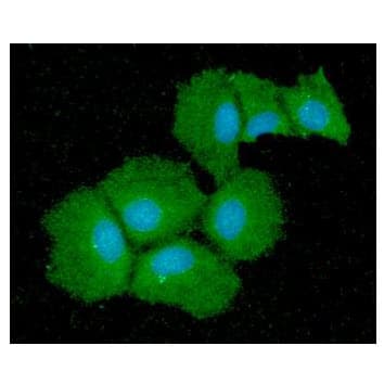 IHC-plus™ QPRT Antibody (clone AT24C4)