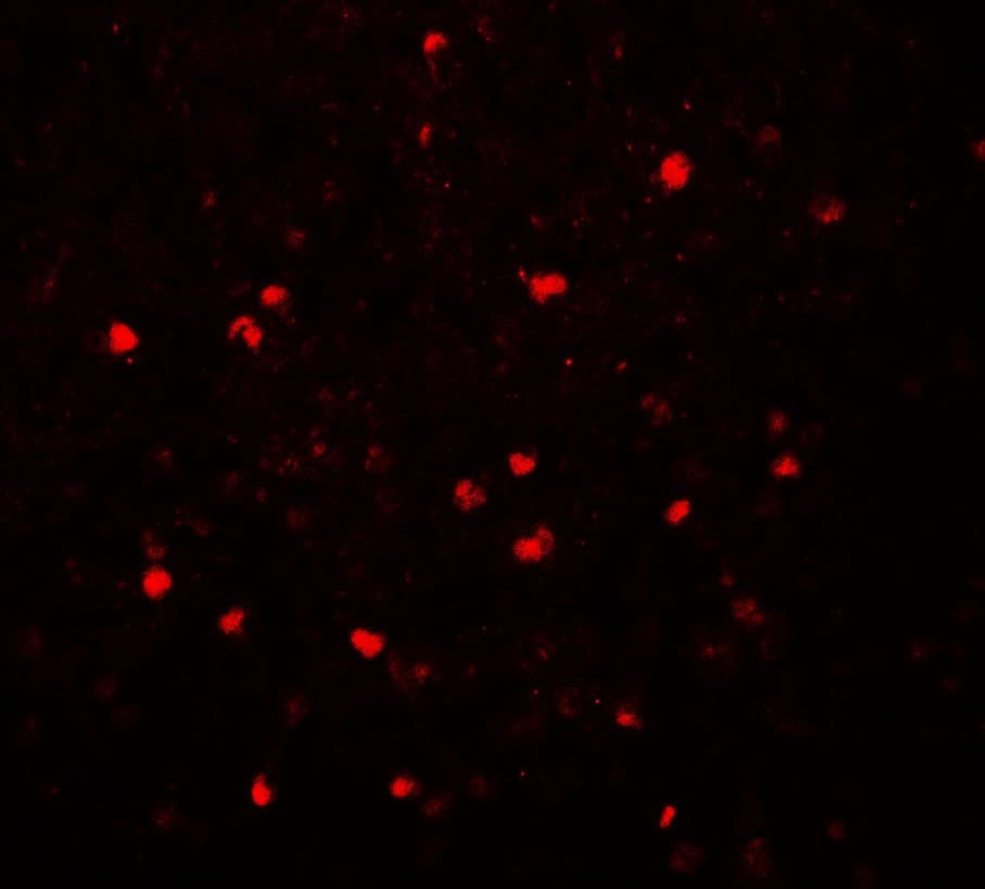 IHC-plus™ Polyclonal Rabbit anti-Human SREBF2 / SREBP2 Antibody (IHC, IF, WB)