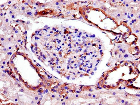 Polyclonal Rabbit anti-Human TRB3 / TRIB3 Antibody (IHC)