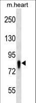 UBASH3A / CLIP4 Antibody (aa313-340)