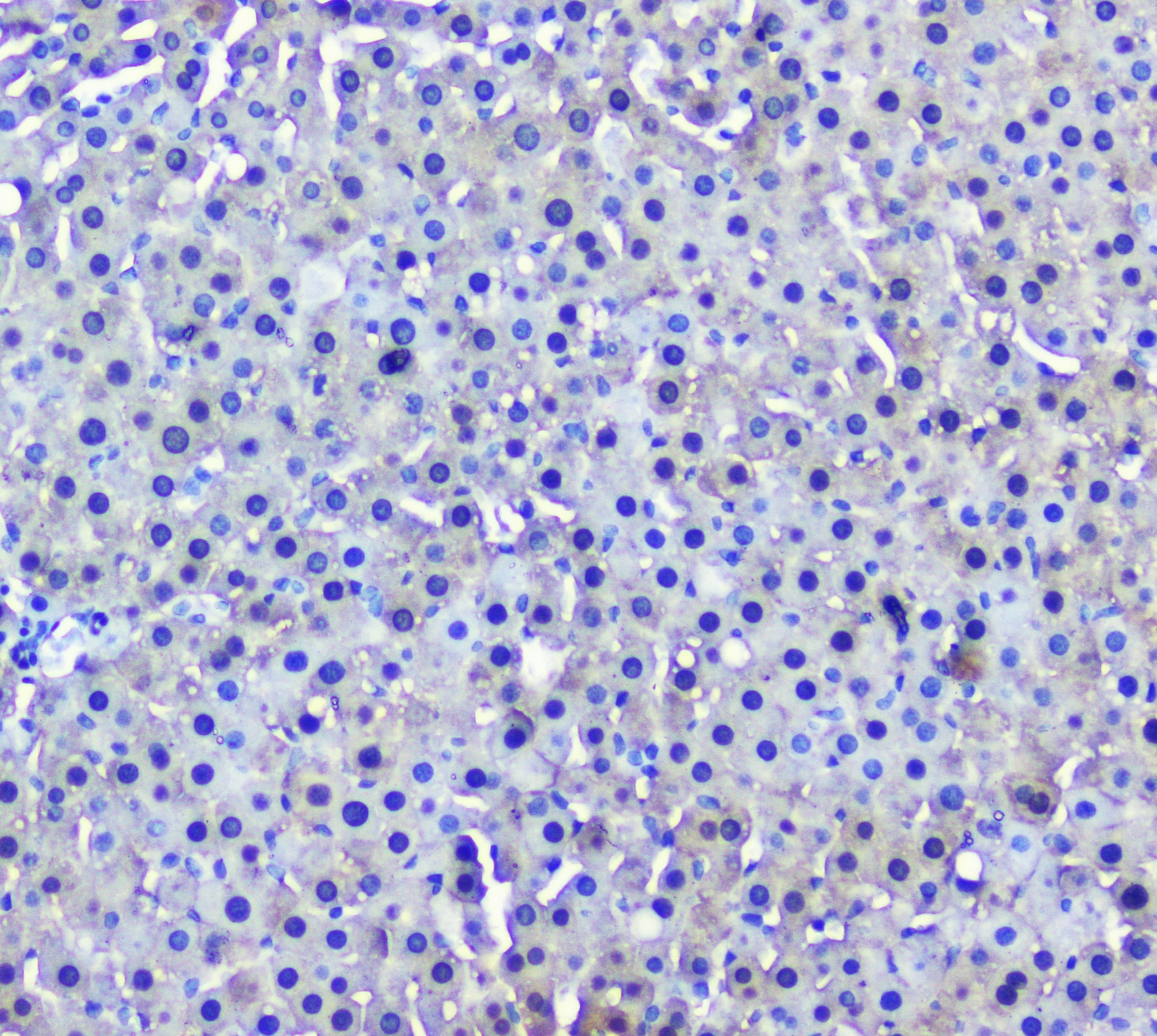 GSTM1 Antibody
