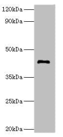 TDG / Thymine DNA Glycosylase Antibody (aa141-410)