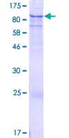 Human ACSS3 Protein (Recombinant GST)