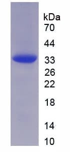 Human CHGB / Chromogranin B Protein (Recombinant His-T7)