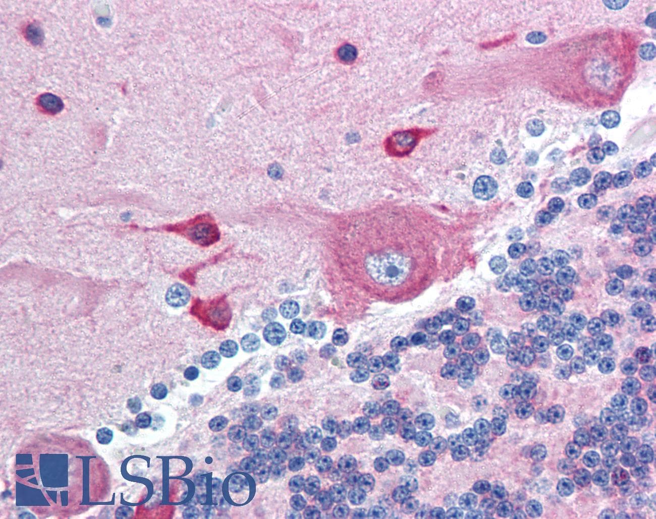 IHC-plus™ PACSIN2 Antibody (aa400-450)
