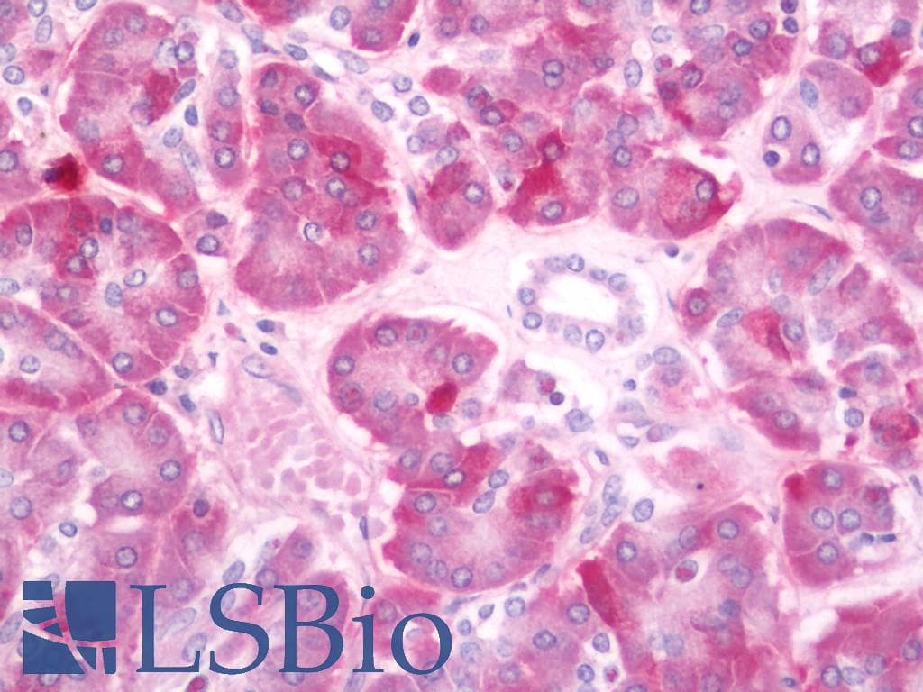 IHC-plus™ PRKCA / PKC-Alpha Antibody (aa623-672)