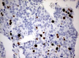 MKI67 / Ki67 Antibody (aa1160-1493, clone OTI8B11)