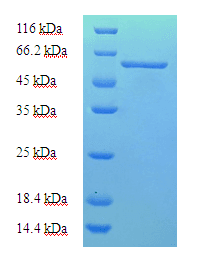 Human SH3GLB2 / Endophilin-B2 Protein (Recombinant His-SUMO)