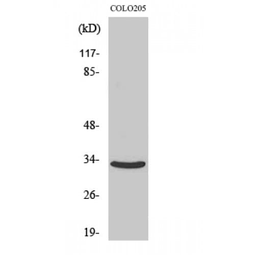 CNR2 / CB2 Antibody (170-250 aa, Internal)
