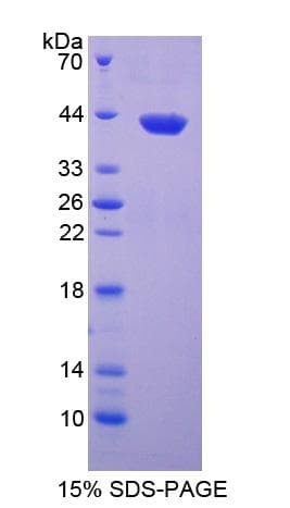 Human INHA / Inhibin Alpha Protein (Recombinant His-T7)