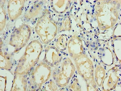 TAF1C Antibody (aa70-320)