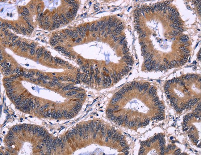 NFAT4 / NFATC3 Antibody