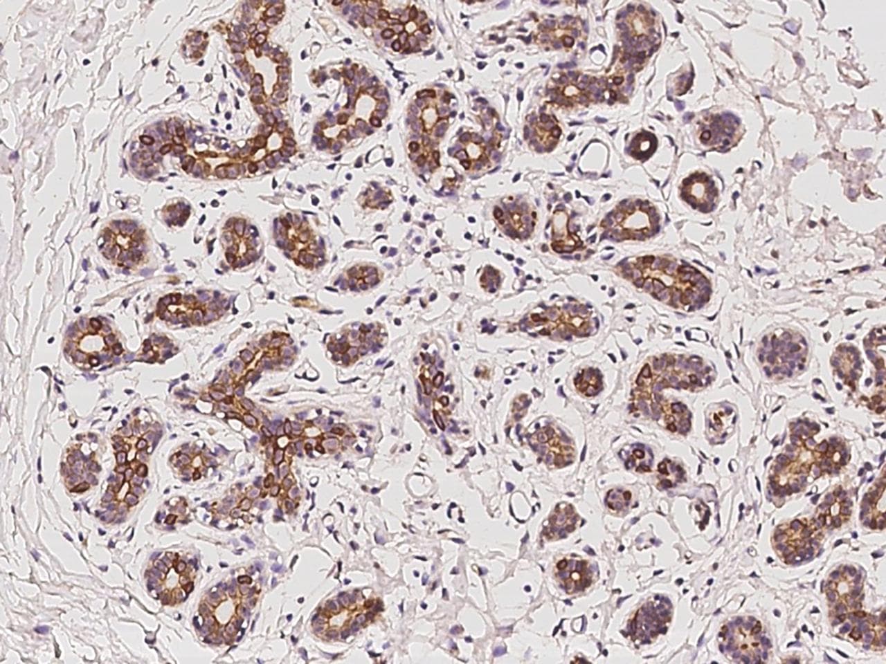 PKN3 Antibody