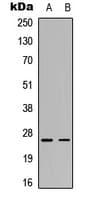 C1QG / Complement C1QC Antibody (Internal)