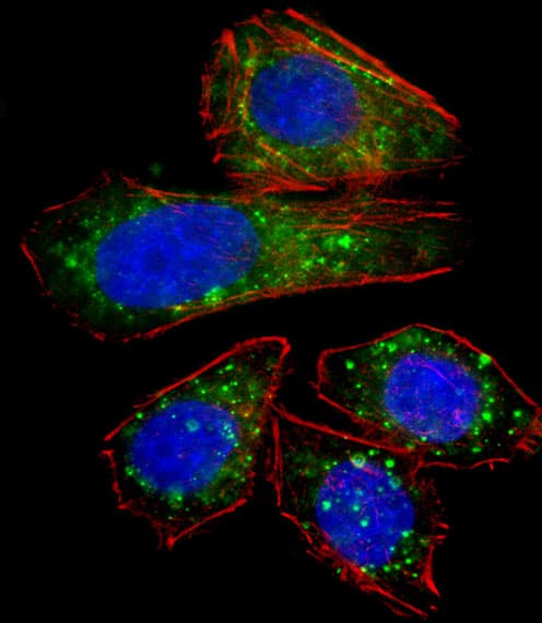 ZNF81 Antibody (aa169-197)