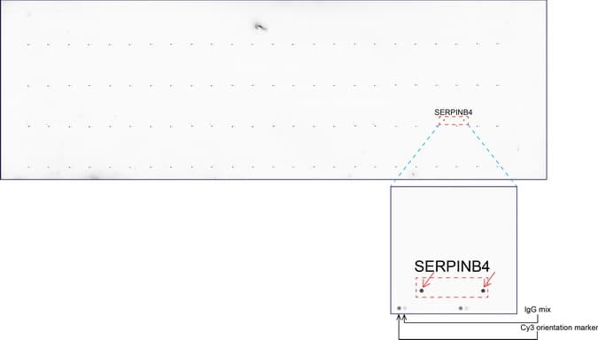 SERPINB4 / SCCA1+2 Antibody (clone UMAB16)
